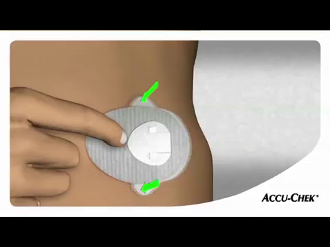 Accu Chek TenderLink infuzijos rinkinys